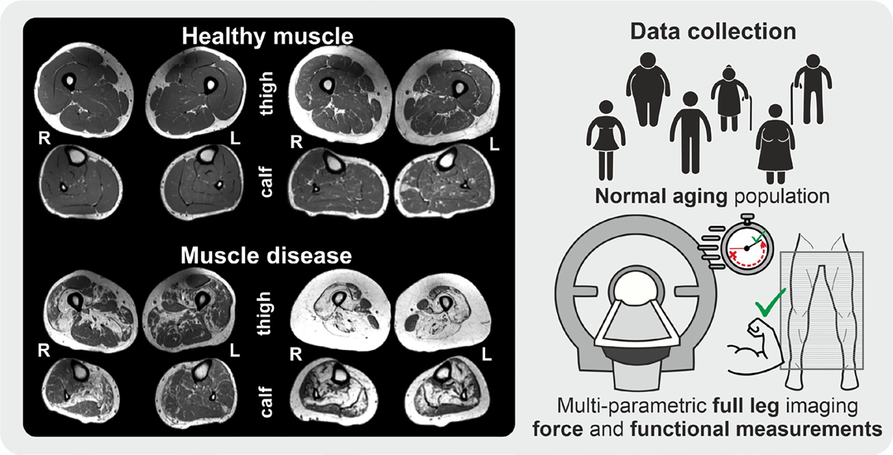 Population based acquisition of quantitative muscle MRI data in normal aging population